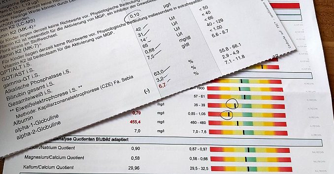 Leistungen der gesetzlichen Krankenkassen sind oft eingeschränkt bei alternativen Heilmethoden und Therapieansätzen