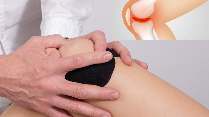 Gelenkbeschwerden wie Arthrose vorbeugen und lindern